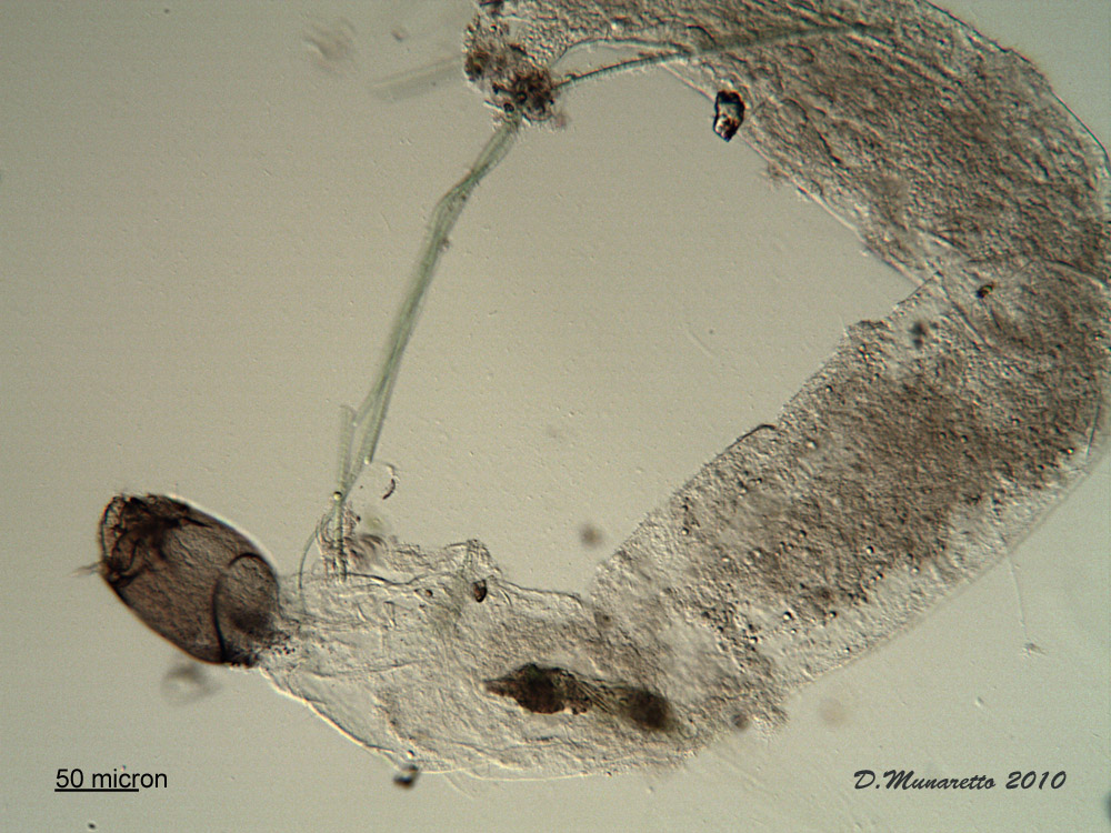 Larva di Chironomide...